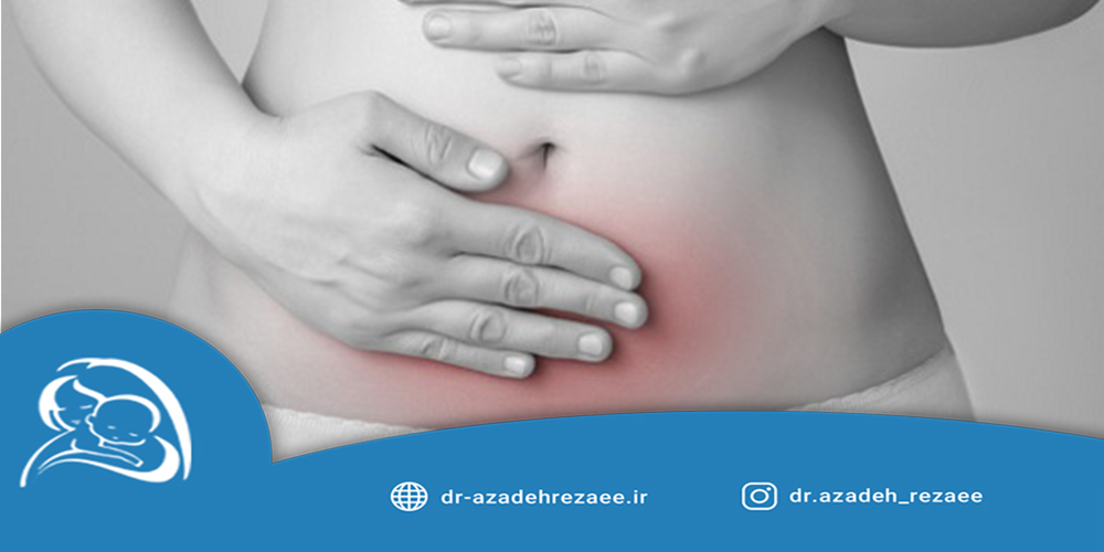 علائم آندومتریوز