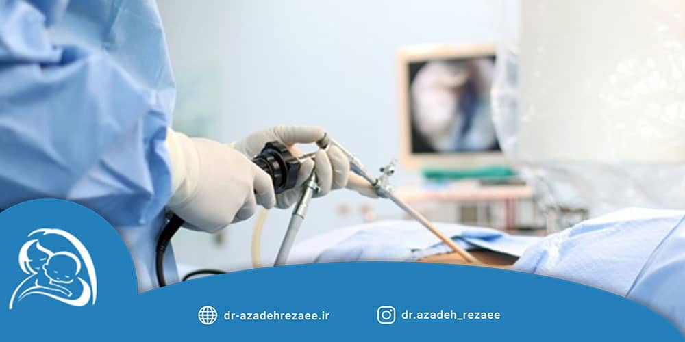 مزایای لاپاراسکوپی رحم و تخمدان - مطب دکتر رضایی در تهران
